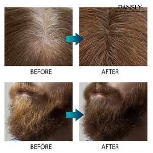 Pansly rasoio Bump essenza Spray trattamento Anti-grigio a base di erbe proteine naturali barba nero a bianco cura dei capelli-prevenzione della perdita di capelli - Product Image 6