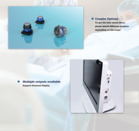 YKD-9022 tout-en-un caméra d'hystéroscope médical portable système de caméra d'endoscopie d'endoscope full hd