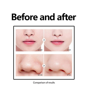 มาส์กกำจัดสิวเสี้ยน West&Month พร้อมบำรุงผิวชุ่มชื้น ทำความสะอาดผิวหน้า ลดรอยสิว รูขุมขนกระชับ - Product Image 4