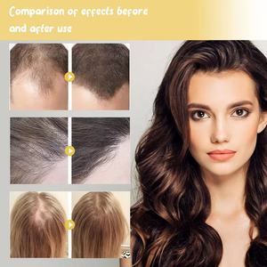 Aceite de Batana 100% Puro y Natural Orgánico al por Mayor para Promover el Crecimiento Saludable del Cabello - Product Image 6