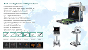 Sistema de Ultrasonido 4D Profesional Rayman con Función Doppler PW CW para Aplicaciones de Cardiología - Product Image 4