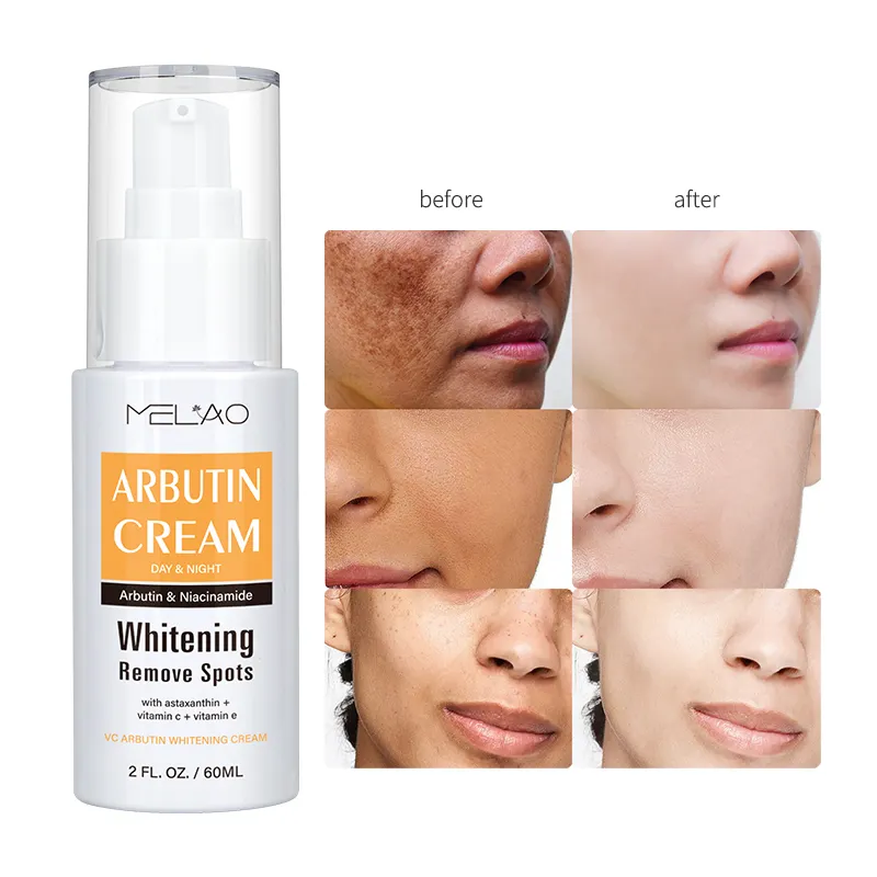 Custom Vitamine C Arbutine Puistjes Donkere Vlek Remover Crème Pigment Melanine Dark Spot Corrector Gezicht Crème Voor Donkere Vlek In gezicht