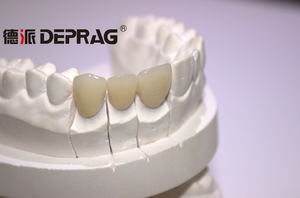De alta calidad de CAD/CAM personalizado de circonio corona Dental - Product Image 6