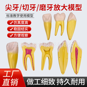 Modelo de dientes incisivos, caninos y molares humanos ampliados 12 veces; herramienta didáctica para el desmontaje anatómico de la pulpa dental y el nervio. - Product Image 1