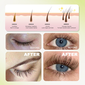 Nuevo Diseño <span class=keywords><strong>de</strong></span> Sérum <span class=keywords><strong>de</strong></span> Péptidos <span class=keywords><strong>para</strong></span> <span class=keywords><strong>Pestañas</strong></span> y Cejas Marca Blanca Bajo MOQ Sérum <span class=keywords><strong>para</strong></span> <span class=keywords><strong>Crecimiento</strong></span> y Rizado <span class=keywords><strong>de</strong></span> <span class=keywords><strong>Pestañas</strong></span> Cuidado Posterior <span class=keywords><strong>para</strong></span> Extensiones <span class=keywords><strong>de</strong></span> <span class=keywords><strong>Pestañas</strong></span> - Product Image 4