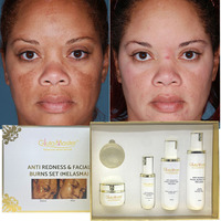 Kit Anti-Rougeurs et Brûlures Cutanées Marque Blanche – Élimine le Mélasma et l'Hyperpigmentation avec Vitamine C – Kit Éclaircissant pour la Peau