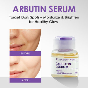 Suero de Arbutina de Grado Profesional para Salón de Belleza, Etiqueta Privada al por Mayor - Blanqueador, Iluminador, Hidratante Nocturno para Rostro y <span class=keywords><strong>Labios</strong></span>, 10ml - Product Image 1