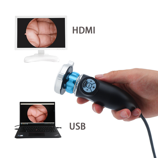 Surgical Medical ENT Endoscope Camera Portable Full HD Endoscopy Camera With HD MI and USB Output Surgical Veterinary Surgery