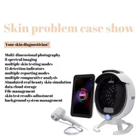 Analyse faciale Scanner de peau 3D Analyse faciale Machine d'analyse faciale Scanner facial Visia 3 caméras Analyseur de peau IA