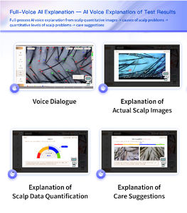 Analyseur de peau et de cuir chevelu AI avec écran tactile, construction en ABS et métal, version sans fil pour les soins capillaires - Product Image 4