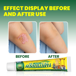 Krim Perawatan Kulit Herbal Cina untuk Tubuh, Pasokan Pabrik, Efektif Meredakan Gatal dan Mengobati Kulit - Product Image 6