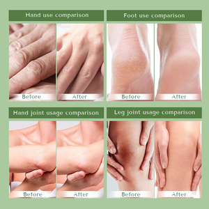 Crema Biologica Vegana per Mani e Piedi con Acido Ialuronico, Sbiancante, Esfoliante e Idratante per Riparazione del Tallone, per Adulti - Product Image 5