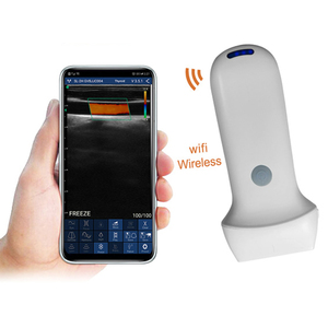 Escáner <span class=keywords><strong>de</strong></span> Ultrasonido Doppler Lineal Portátil Inalámbrico <span class=keywords><strong>de</strong></span> Alta Frecuencia CProbe-8L para Exámenes <span class=keywords><strong>de</strong></span> Piel, Vasos Sanguíneos y Senos - Product Image 2