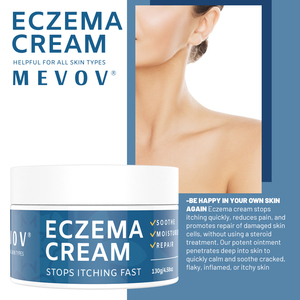 Crema para Eczema y Psoriasis de Marca Privada con Glicerina para Hidratar, Reducir el Enrojecimiento, Efectos <span class=keywords><strong>Antiinflamatorios</strong></span> y Nutritivos - Product Image 3