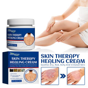 Krim Kecantikan dan Perawatan Kulit Salep <span class=keywords><strong>Psoriasis</strong></span> untuk Pengobatan Krim <span class=keywords><strong>Herbal</strong></span> untuk Perawatan Eksim Perawatan Perbaikan Kulit - Product Image 3