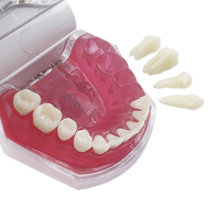 YOUYA DENTAL MX-038 Modèle dentaire en résine, dents amovibles, modèle anatomique pour l'étude et l'enseignement, gingive souple, Typodont