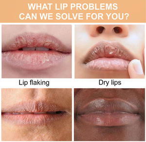 Baume à lèvres personnalisé à étiquette privée, hydratant, hydratant, atténuant les ridules, baume à lèvres au curcuma, baume au beurre - Product Image 4