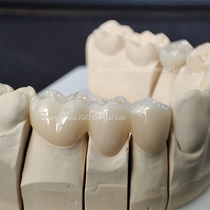 OEM/ODM servizi di laboratorio odontoiatrico perfetto aspetto belle corone in ceramica di <span class=keywords><strong>Zirconia</strong></span> con gomma realistica in Cina laboratorio odontoiatrico - Product Image 4