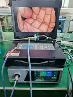 Système de caméra endoscopique médicale portable HD – Unité d'endoscopie ORL, urétéroscope, gastroscope, colonoscope, laparoscope
