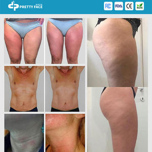 Venta caliente Escritorio ABS Endos Rodillo Celulitis Masaje Drenaje linfático Bola interna Cuerpo facial Terapia de rodadura endosférica delgada - Product Image 5