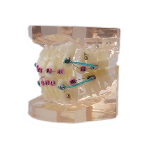 Modèle de dents dentaires/modèle orthodontique <span class=keywords><strong>dentaire</strong></span> avec supports métalliques - Product Image 3