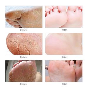 Masque exfoliant blanchissant pour les mains et les pieds, crème pour adultes, 1 paire/sac de papier d'aluminium vierge, marque privée, OEM/ODM - Product Image 4