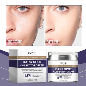 <span class=keywords><strong>Crema</strong></span> Facial <span class=keywords><strong>Hidratante</strong></span> e Iluminadora para <span class=keywords><strong>Piel</strong></span> <span class=keywords><strong>Grasa</strong></span> Hoygi para Niños - Product Image 3