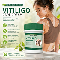 Krim Perawatan Vitiligo Logo Kustom Anda 30g, Cepat Menyerap, Lembut, Menyeimbangkan, Melembapkan, Meratakan Warna Kulit, Perawatan Efektif