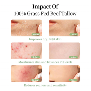 100% 天然 プライベートブランド 牛脂バームクリーム：グラスフェッド オーガニック フェイス＆ボディバームローション - Product Image 6