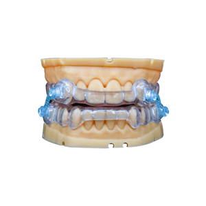<span class=keywords><strong>Appareil</strong></span> d'expansion <span class=keywords><strong>dentaire</strong></span> amovible de classe II, plaque orthodontique en acrylique pour le redressement des dents, personnalisation - Product Image 6
