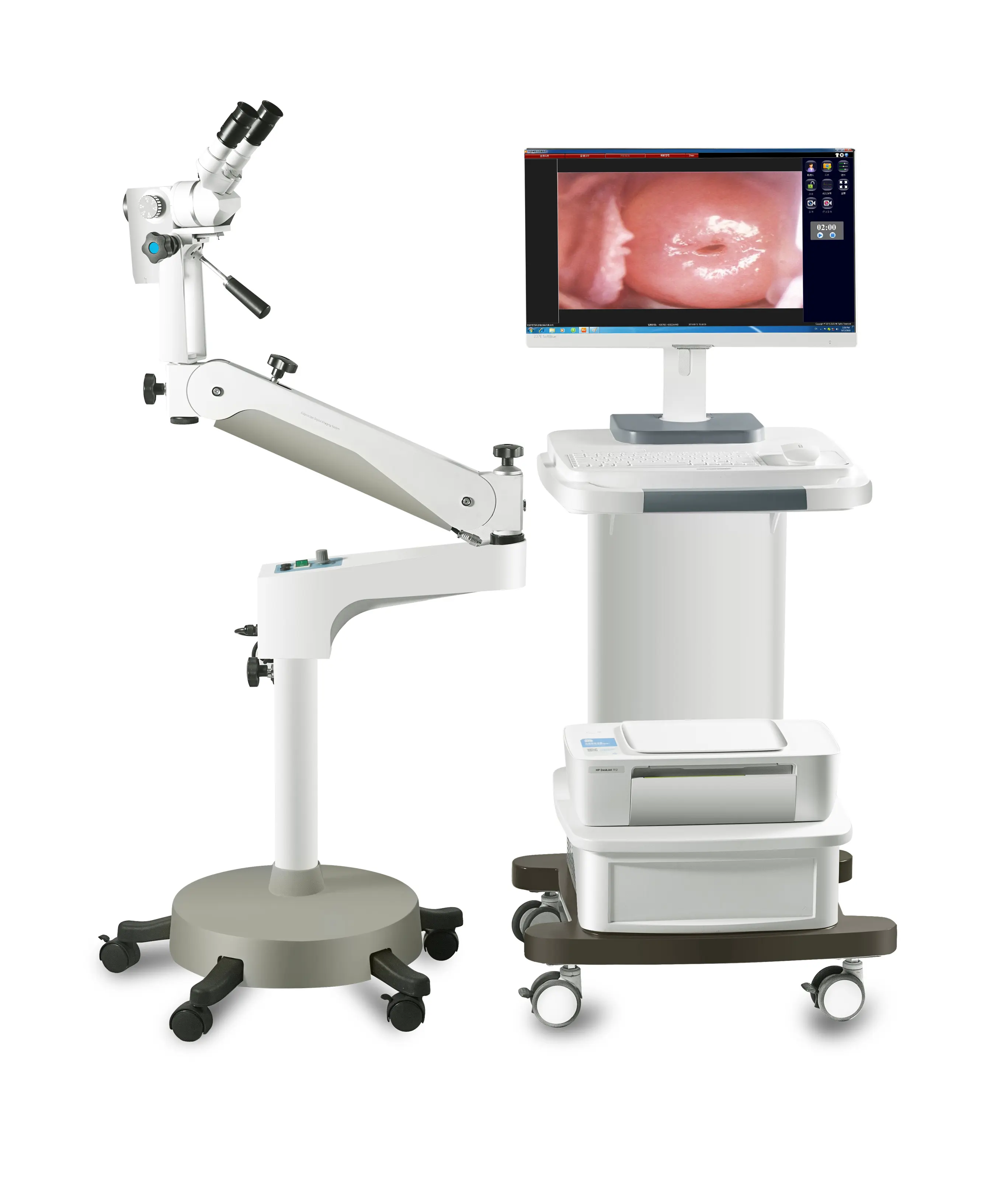 CE onaylı dijital optik kolposkop sistemi Video jinekoloji kolposkop vajina optik kolposkop