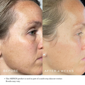 Productos para el cuidado de la piel de etiqueta privada suero antienvejecimiento Facila con ácido hialurónico suero facial personalizado - Product Image 6