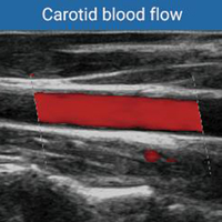 Appareil de Diagnostic Échographique Couleur 3D/4D/5D, Échographe Médical Portable Exclusif