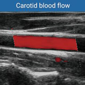 Alat diagnostik ultrasonik warna 3D/4D/5D, pemindai Ultrasound eksklusif portabel, peralatan Ultrasound - Product Image 6