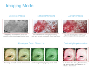 เครื่องมือถ่ายภาพ KN 2200 สำหรับการตรวจภายในช่องคลอด ปากมดลูก และอวัยวะเพศหญิง เพื่อการดูแลสุขภาพสตรีทั่วไปและการตรวจคัดกรองมะเร็งปากมดลูก - Product Image 4