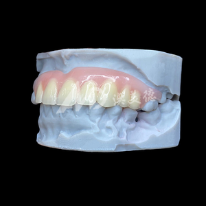 Prothèse <span class=keywords><strong>dentaire</strong></span> partielle amovible sur mesure à haute confortabilité, flexible, acceptant les commandes d'externalisation et les fichiers STL - Product Image 2