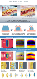 2026 máy giảm cellulite mới đến loại bỏ chất béo cứng đầu cho kết quả trông tự nhiên - Product Image 3