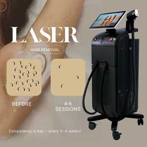 808nm diode laser épilation 3 vagues triple trio 755 1064nm 810nm diode laser maquina de depilacion laser - Product Image 6