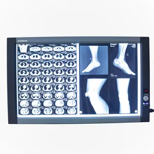 Tandheelkundige Medische Single/Double/Triple Panel Medische X-Ray Film View Box Ultradunne Led Box Illuminator Negatoscoop