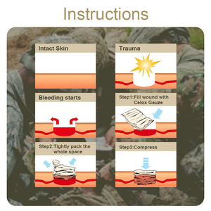 Прямая поставка с завода, горячая распродажа, раневая повязка, экстренная рентгеновская Гемостатическая Марля хитозана - Product Image 5