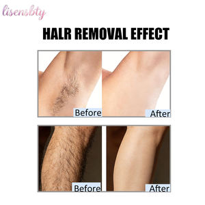 เครื่องกำจัดขนด้วยไดโอดแบบมืออาชีพ 2 in 1 สำหรับกำจัดขนทั่วร่างกาย กำจัดรอย<span class=keywords><strong>สัก</strong></span> และฟื้นฟูผิวแบบตั้งโต๊ะ - Product Image 5