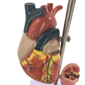 Анатомические модели для демонстрации диабета - Product Image 4