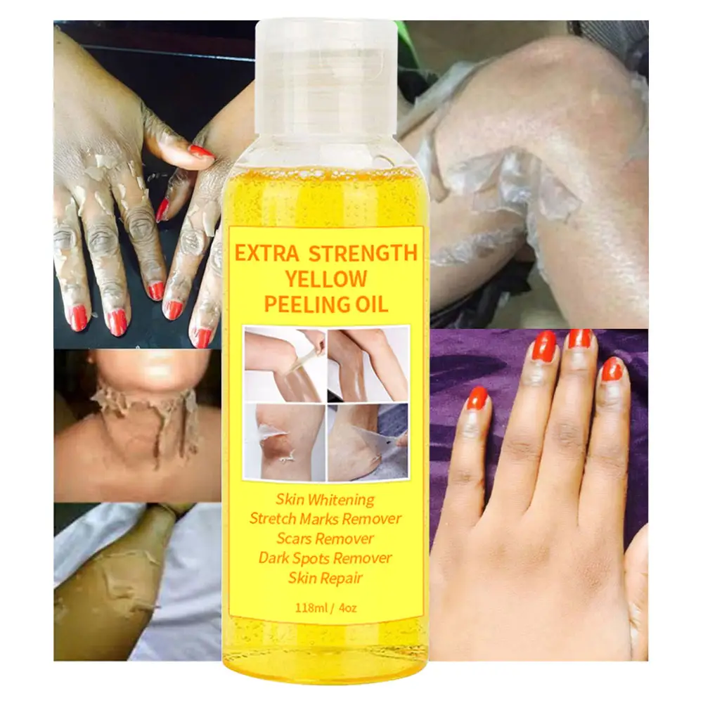 Private Label Extra Strength Yellow Peeling Oil Knöchel Haut aufhellung Entfernen Sie abgestorbene Haut Peeling Anti Dark Spots Oil