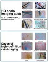 2026 Latest Desktop Al-powered Multi-spectral Imaging Hair Analyzer Scalp Microscope 200x Magnification for Home Commercial Use