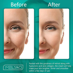 <span class=keywords><strong>Crema</strong></span> Antirughe Giorno e Notte <span class=keywords><strong>Crema</strong></span> Idratante <span class=keywords><strong>Viso</strong></span> Anti-Età <span class=keywords><strong>per</strong></span> Donne - Product Image 5