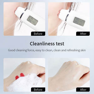 Mejor <span class=keywords><strong>precio</strong></span> 377 Limpiador facial natural Blanqueamiento de arroz <span class=keywords><strong>Gel</strong></span> de limpieza profunda para el tratamiento del acné Aminoácido a base de silicona Herbal - Product Image 6