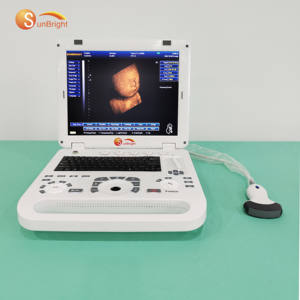 Ecógrafo Portátil de Alta Potencia con Doppler Color, Escáner de Ultrasonido Fetal 3D - Product Image 1