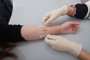 Dispositif de fermeture cutanée jetable pour la réparation des sutures à fermeture rapide - Product Image 6