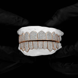 Ensemble de grillz de luxe personnalisés sertis de diamants, haut et bas |   Bijoux dentaires hip-hop en or blanc 14 carats pour hommes et femmes - Product Image 1