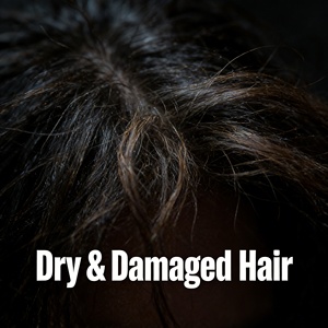 <span class=keywords><strong>Aceite</strong></span> Capilar Gatase <span class=keywords><strong>de</strong></span> <span class=keywords><strong>Almendras</strong></span> y Manteca <span class=keywords><strong>de</strong></span> Karité <span class=keywords><strong>para</strong></span> Cabello Dañado - Reparador, Nutritivo, Control del <span class=keywords><strong>Frizz</strong></span>, Tratamiento <span class=keywords><strong>para</strong></span> Cabello Seco, Puntas Abiertas - Product Image 2